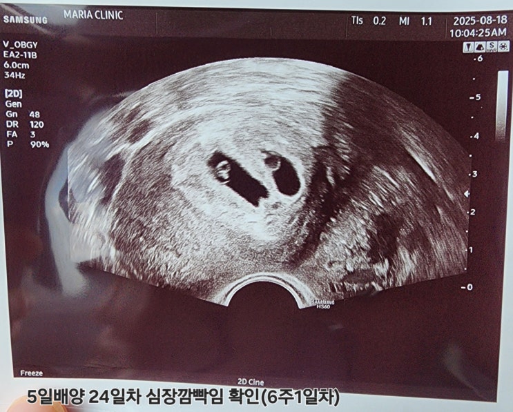 평촌마리아_<b>안양난임병원</b> [11]... 범계역 화재/ 난임병원 졸업