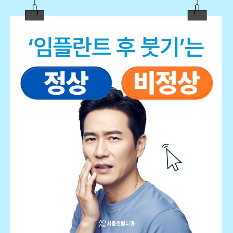  임플란트 붓기 정상인지 애매모호하다면
