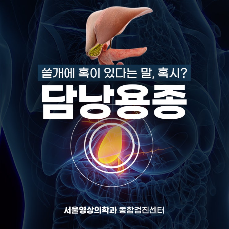  경기광주내과병원, 쓸개에 혹이 있다는 말 혹시 담낭용종