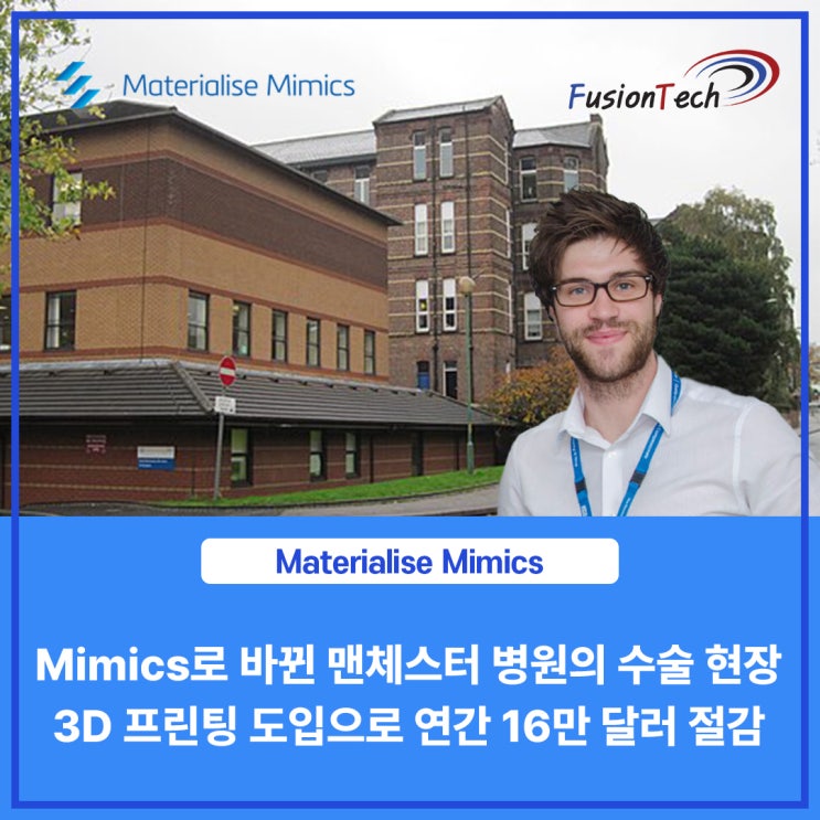  [Materialise S/W] 맨체스터 병원, 3D 프린팅 도입으로 연간 16만 달러 절감, Materialise Mimics로 바뀐 수술 현장