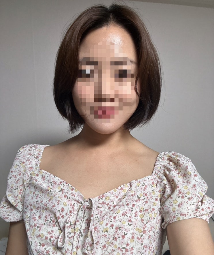  목동역 내돈내산 윤곽주사 후기 (윤곽주사 3회 이상)