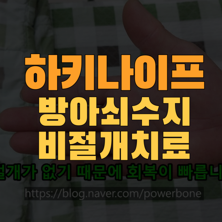  [방아쇠수지] 하키나이프 치료 후 상처 크기,아무는 시간,회복기간