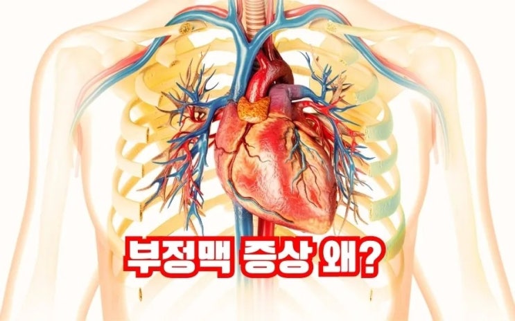  부정맥 뜻? 증상 원인 숨은 부정맥 치료 관리 음식