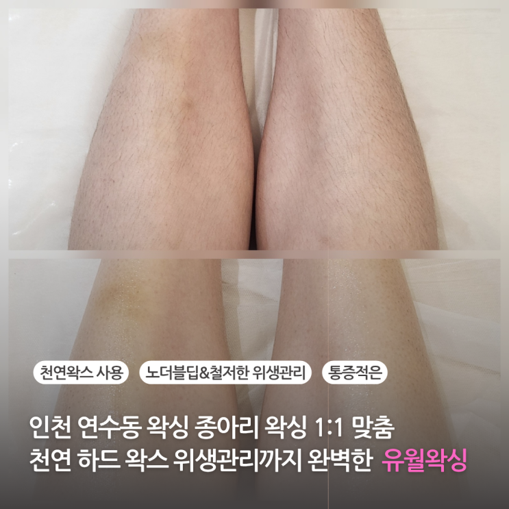  인천 연수동 왁싱 종아리 왁싱 1:1 맞춤 천연 하드 왁스 위생관리까지 완벽한 유월왁싱
