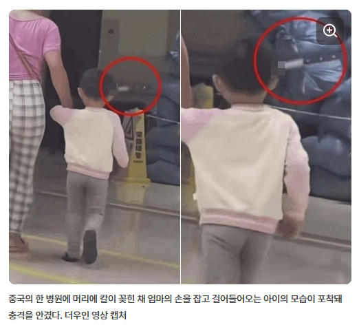  머리에 칼 꽂힌 채 병원 걸어 들어간 3살 아이…중국서 충격 사건