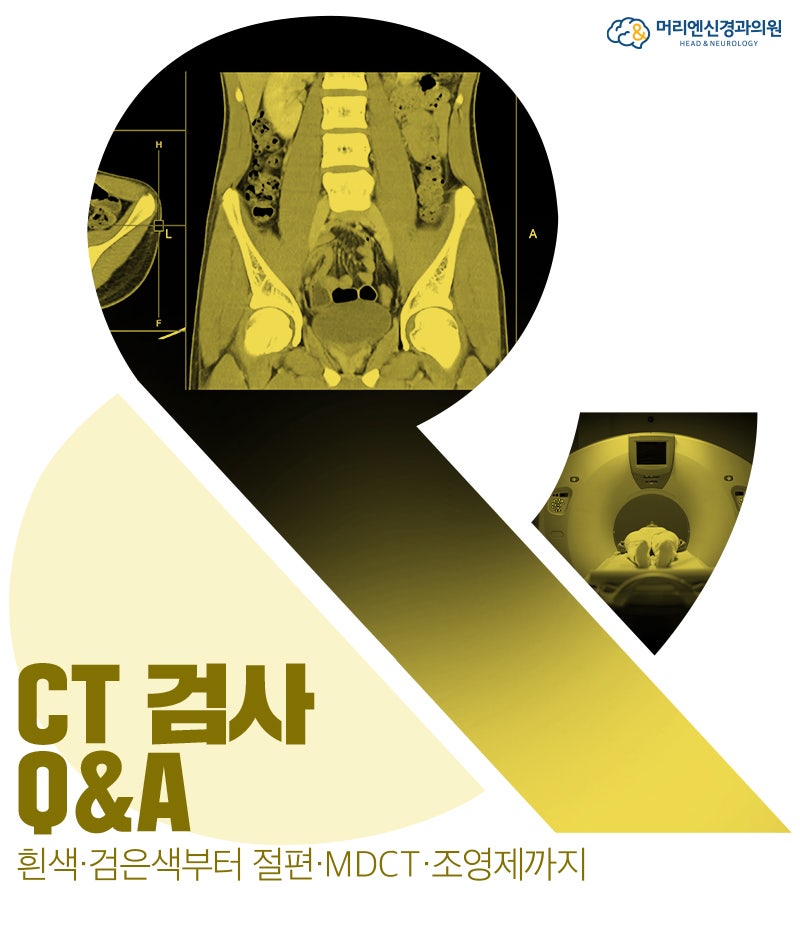 마포신경과, CT 검사 Q&A: 흰색·검은색부터 절편·MDCT·조영제까지