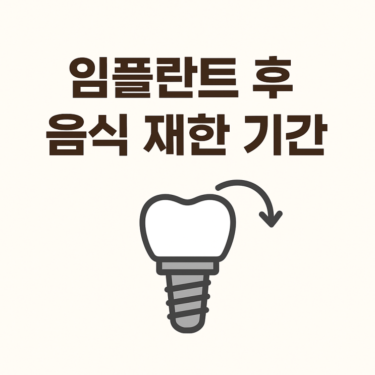   임플란트 후 음식 제한 기간, 얼마나 지켜야 할까요?