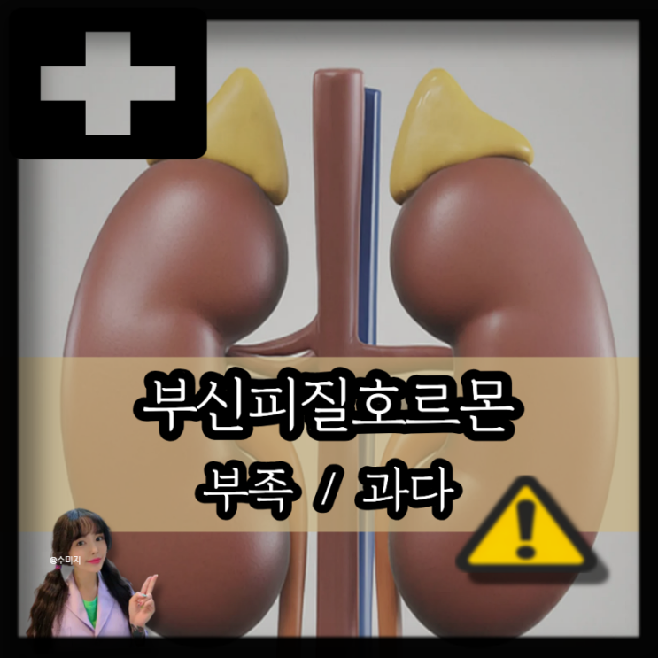  부신피질호르몬 (스테로이드) 부족 과다 증상