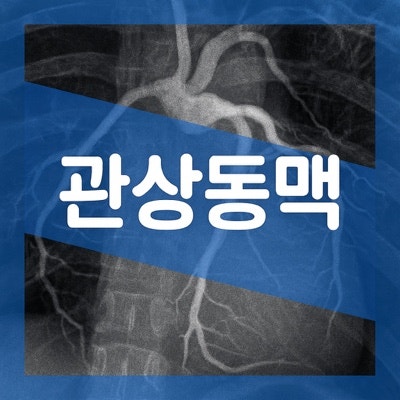 관상동맥 석회화 증상 수치 점수, CT MDCT 검사 치료 방법
