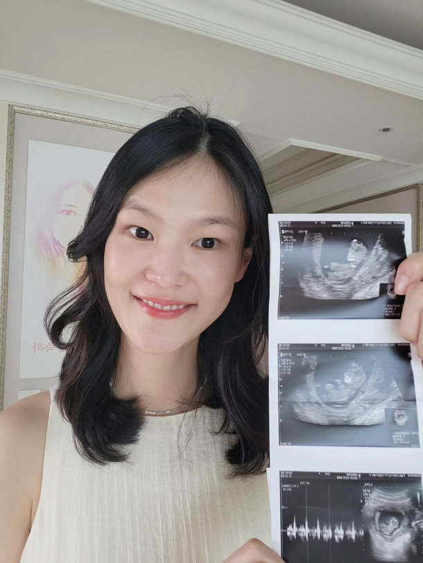 <b>전수민</b><b>김경진</b>, <b>쌍둥이 임신</b>!  드디어 부모 된다!