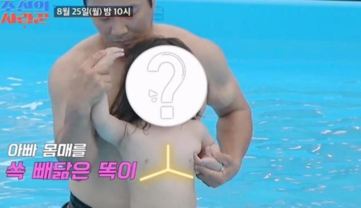 유전자의 신비로움을 보여준 <b>김병만 2세</b>, 태어날 때부터 갈라진... 