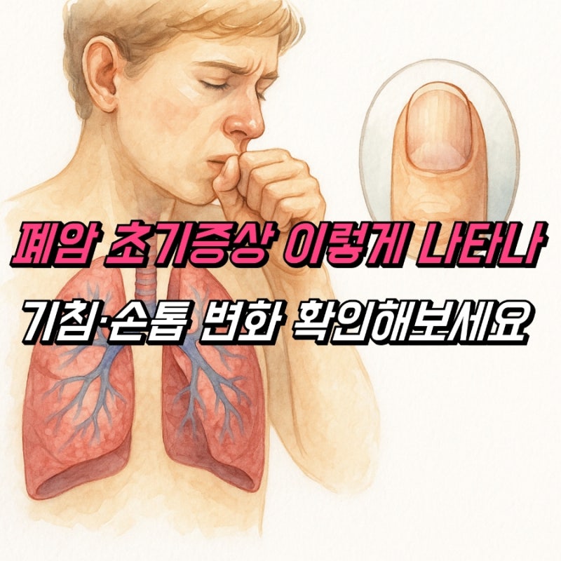 폐암 초기증상 기침 손톱 변화, 늦기전에 확인하세요