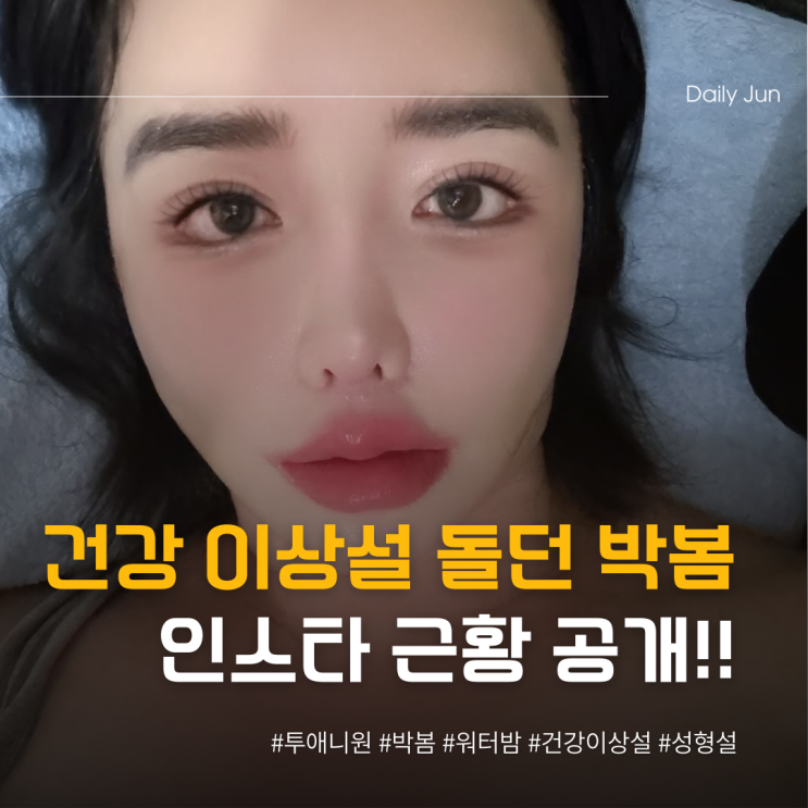  건강 이상설 돌던 박봄 인스타 근황