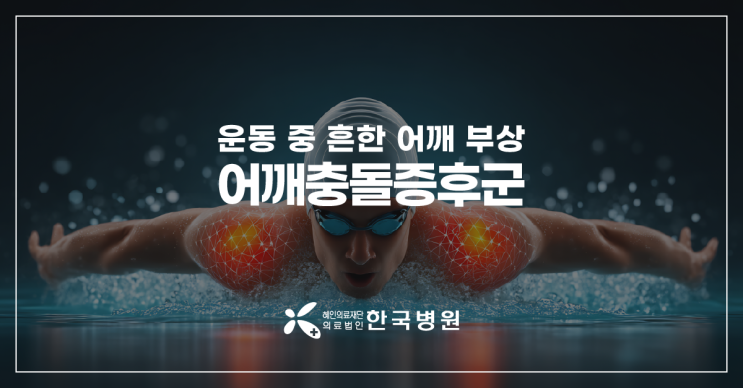  수영 후 어깨통증? 여름철 흔해지는 어깨충돌증후군 특징은