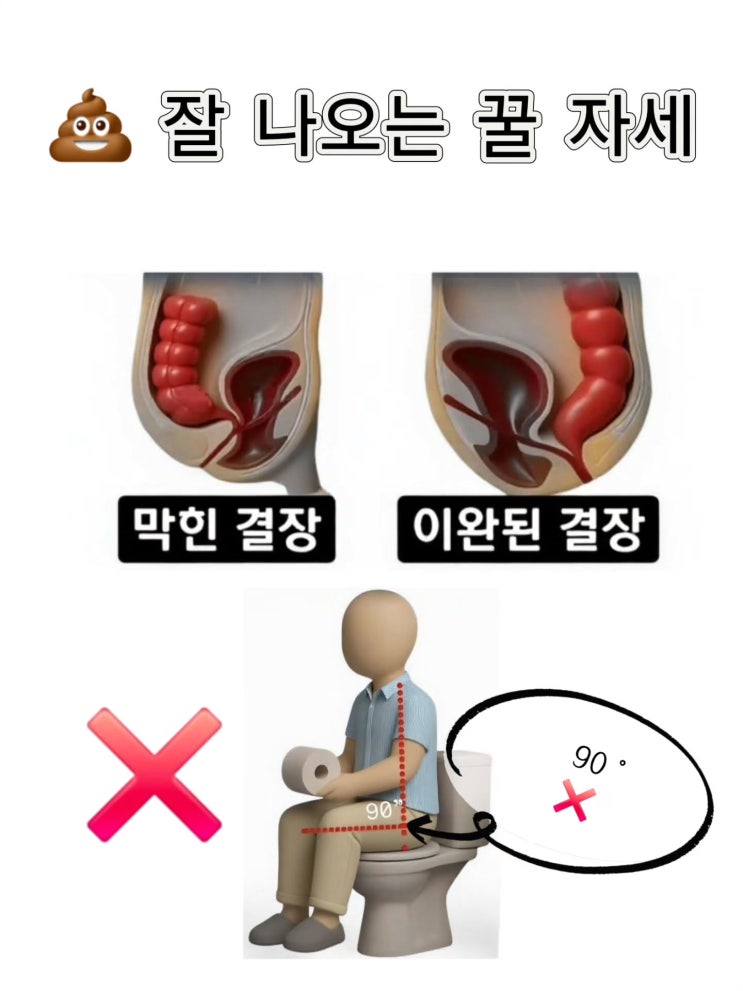  화장실에서 응가 잘보는방법?