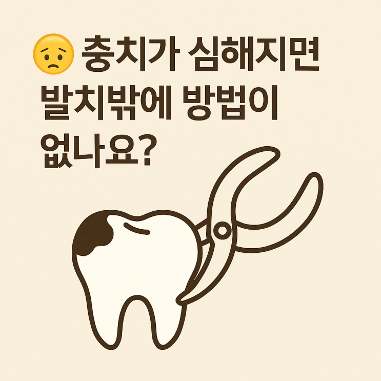   충치가 심해지면 발치밖에 방법이 없나요?