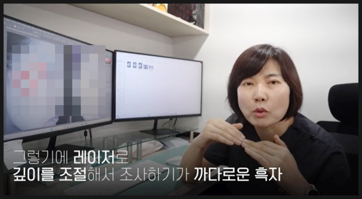  흑자제거가격 대구에서도 찾아오시네요
