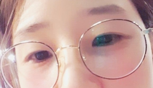  " 눈에 좋은 영양소 7가지와 하루 5분 눈 운동으로 건강한  만들기"