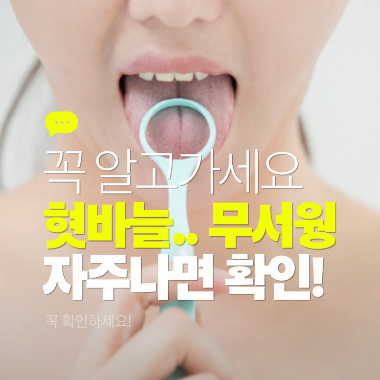  혓바늘 빨리 없애는법 연고 약? 좋은 음식? 알아봐요