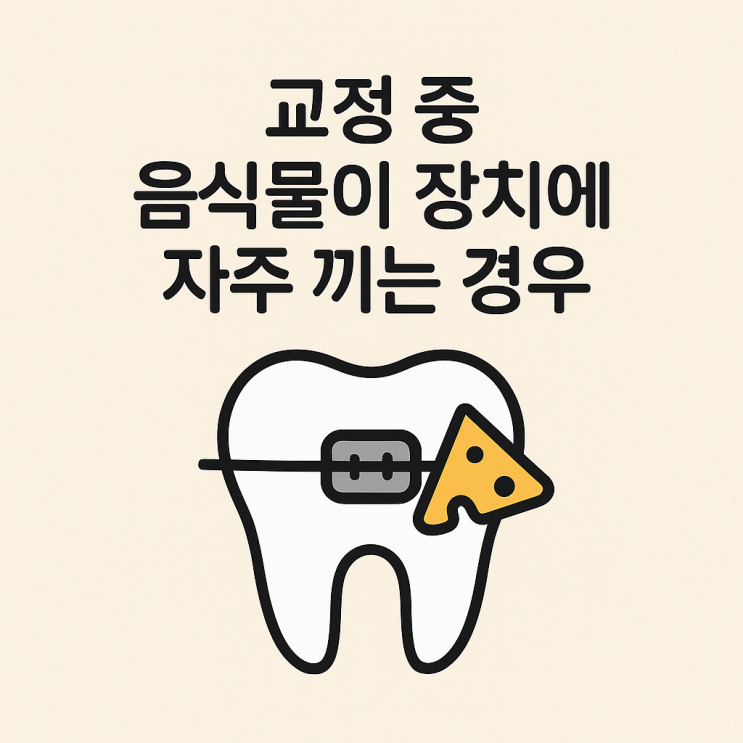   교정 중 음식물이 장치에 자주 끼는 경우