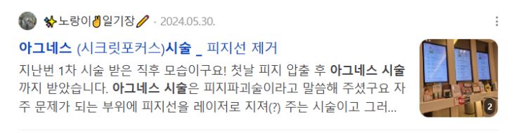  지긋지긋한 화농성여드름치료  아그네스레이저 피지선파괴술(시크릿포커스) 내돈내산 찐 후기