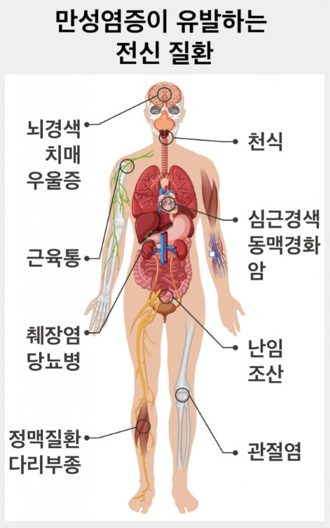  만성염증, 노화의 숨은 원인? 운중동한의원에서 관리하세요