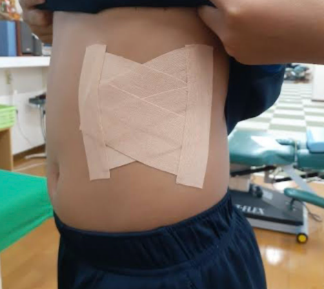  갈비뼈 통증, 놓치기 쉬운 원인과 경험담