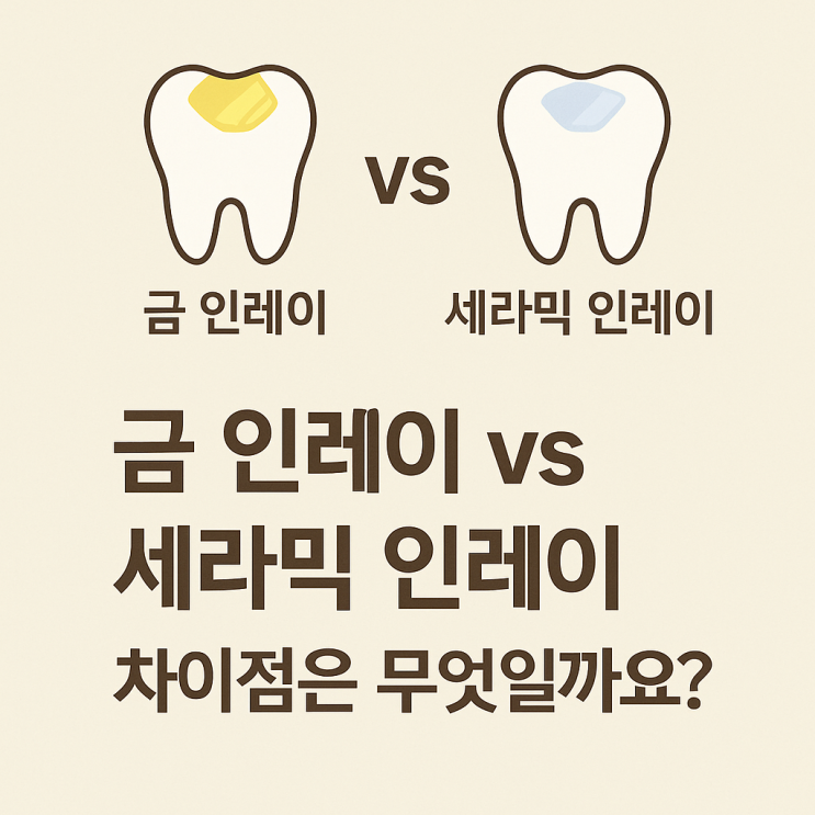   금 인레이 vs 세라믹 인레이, 차이점은 무엇일까요?