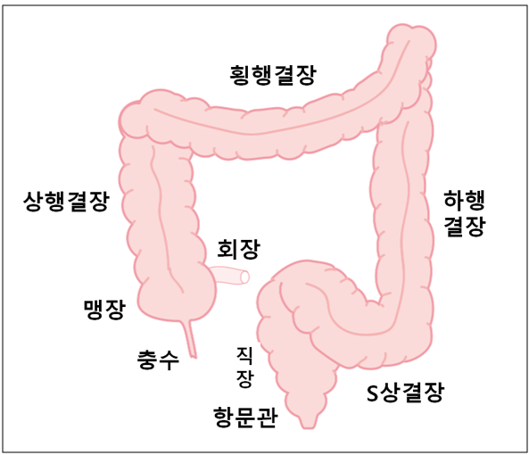 대장암 생존율과 초기증상 및 예방과 검사 방법은?