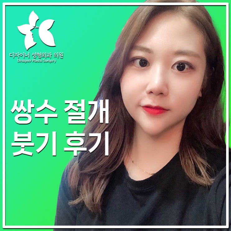  쌍수 절개 붓기 후기: 회복 과정과 알아두면 좋은 정보
