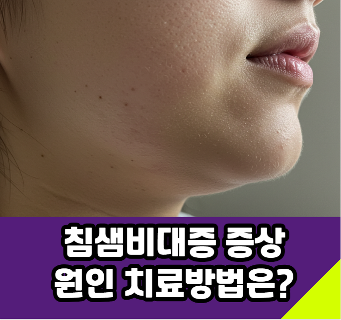 침샘비대증 증상/원인 치료방법은?