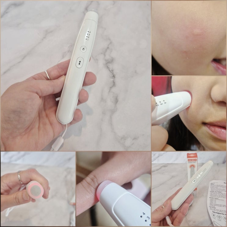  모기물렸을때 가려움 빨리 잡는 법 WAP 온열스틱 후기