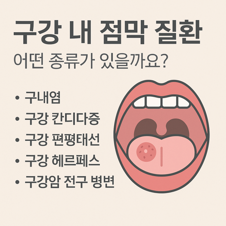   구강 내 점막 질환, 어떤 종류가 있을까요?