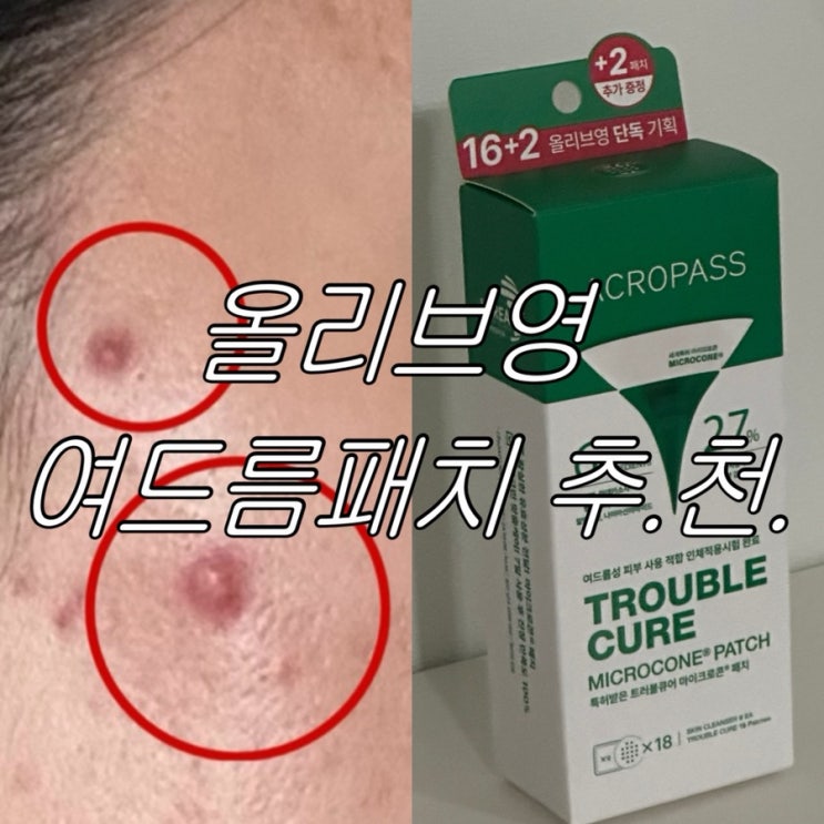 내돈내산ㅣ올리브영 니들 여드름패치 추천 왕여드름 사용 후기(feat. 츄)