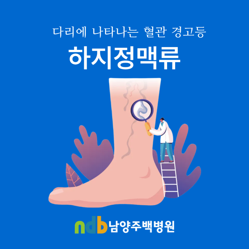 남양주 진접 하지정맥류 초기 증상, 다리 혈관 경고등 켜졌다면?