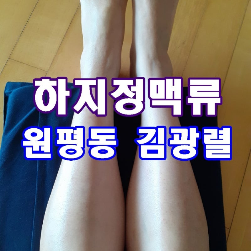 구미 하지정맥류 없다고 안심하면 더 위험할 수도 하지정맥 검사 병원 치료 어떻게
