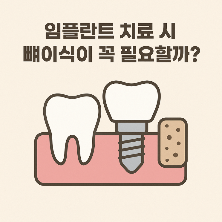   임플란트 치료 시 뼈이식이 꼭 필요할까?
