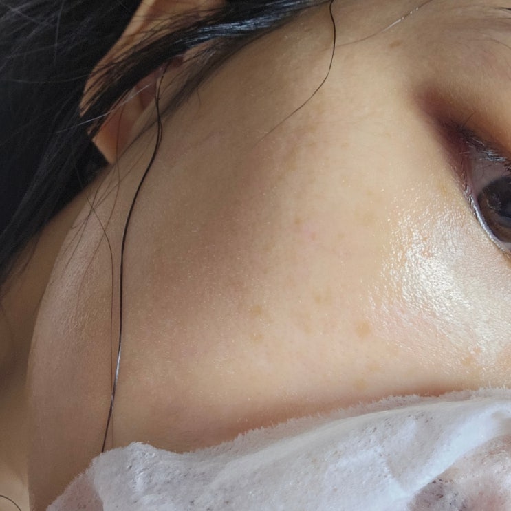  피부과 머미팩 내피부맞춤으로 홈케어할수있는 홈팩토리 닥토팩토