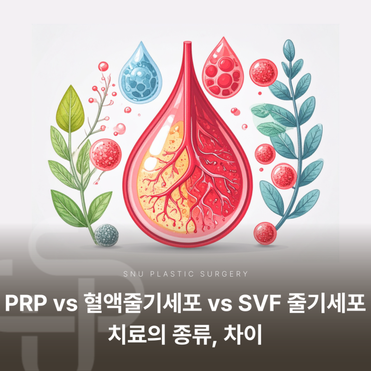  PRP vs 혈액줄기세포 vs SVF 줄기세포 치료의 종류, 차이