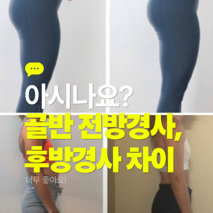  골반 전방경사 후방경사 차이 최고의 교정 스트레칭 운동 TOP3