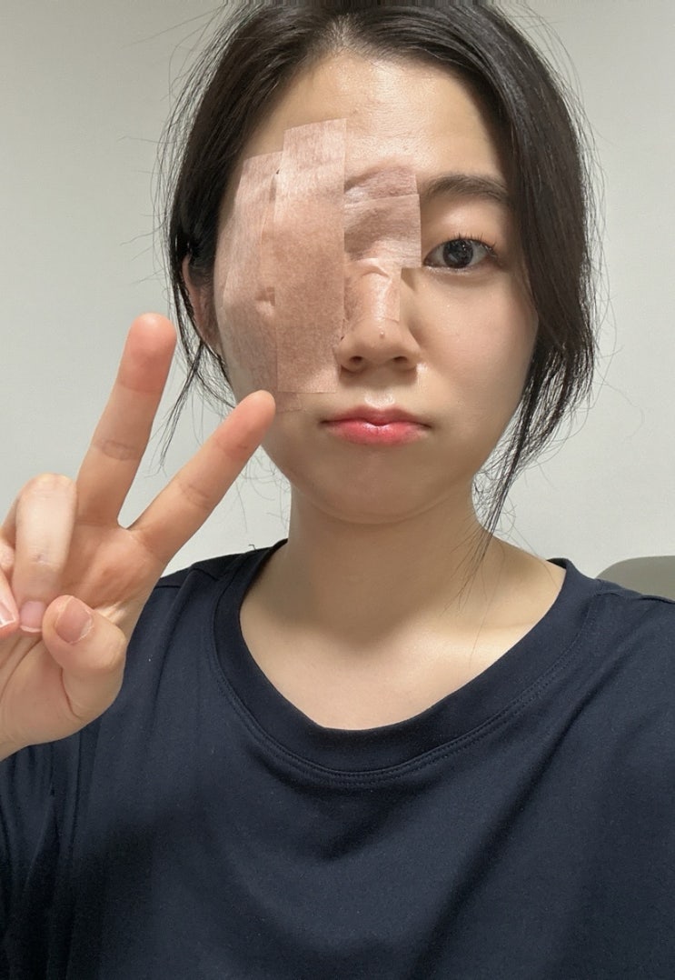  다래끼 수술 후기