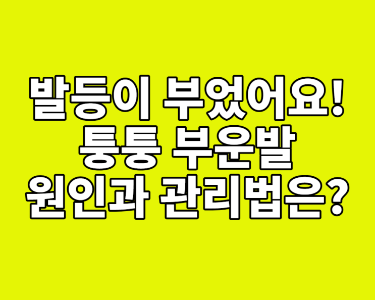  발등이 부었어요! 퉁퉁 부은 발, 원인과 관리법은? (병원 가야 할 신호)