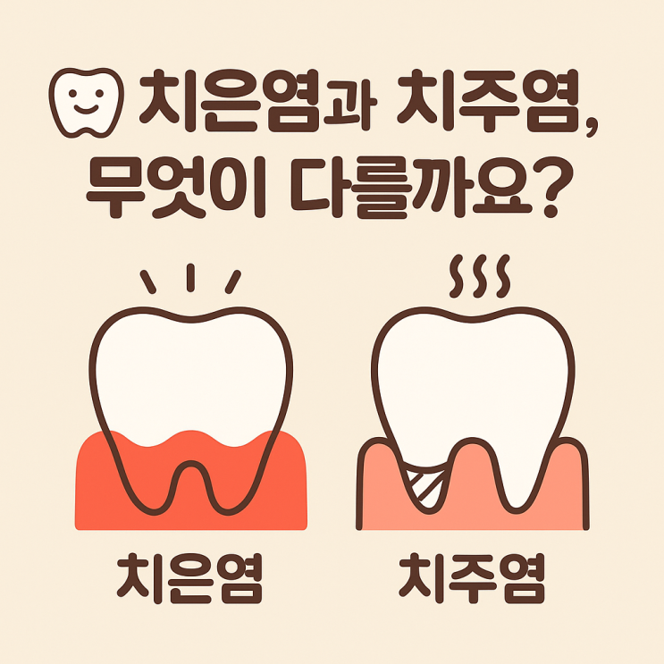   치은염과 치주염, 무엇이 다를까요?