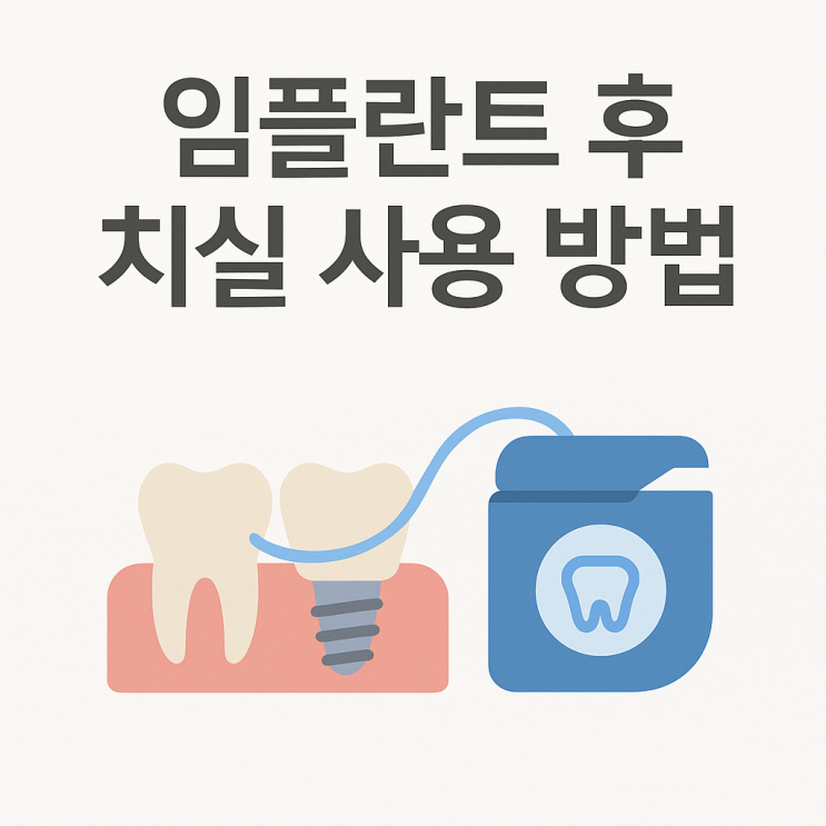   임플란트 후 치실 사용 방법 — 올바른 관리가 중요한 이유