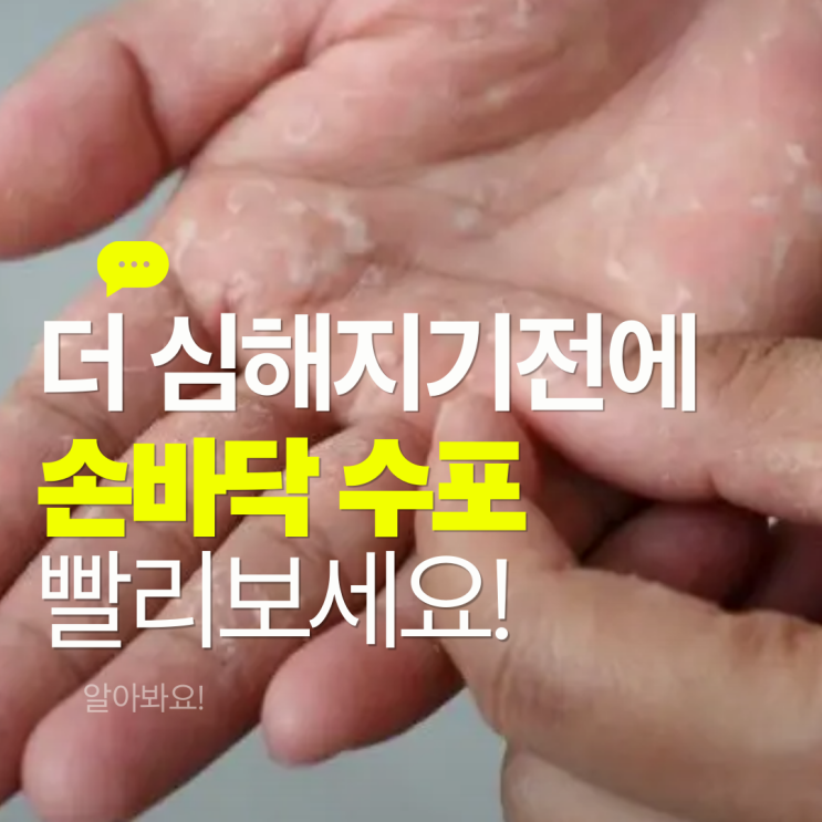  손바닥에 수포 생기는 이유 4가지! 손바닥 수포 원인 증상 알아봐요!