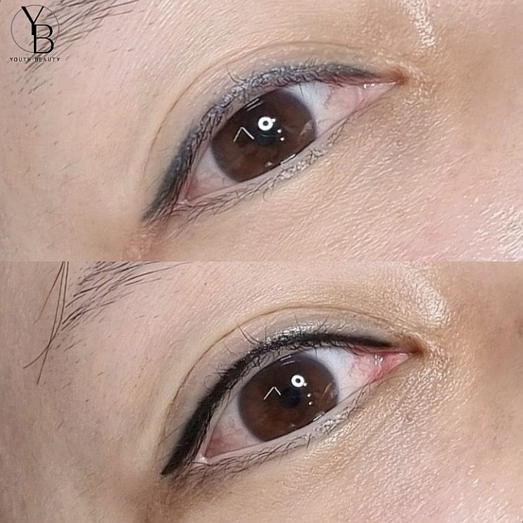  광주아이라인문신 푸른 아이라인 커버업 커버업!