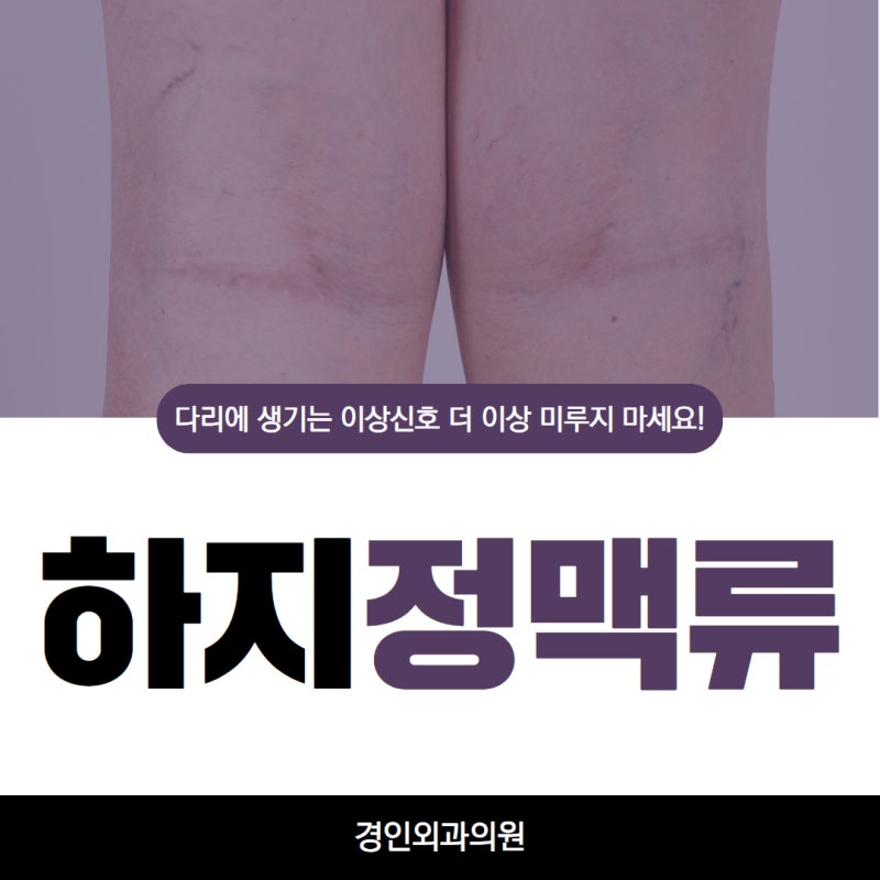 부천하지정맥, 다리에 생기는 이상신호 더 이상 미루지 마세요!