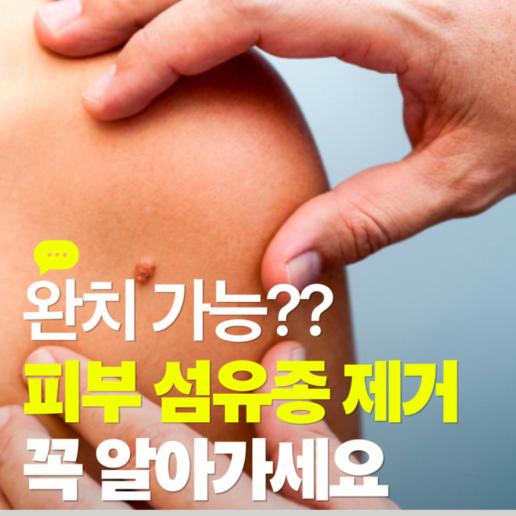  피부 섬유종 제거 완치 가능할까?