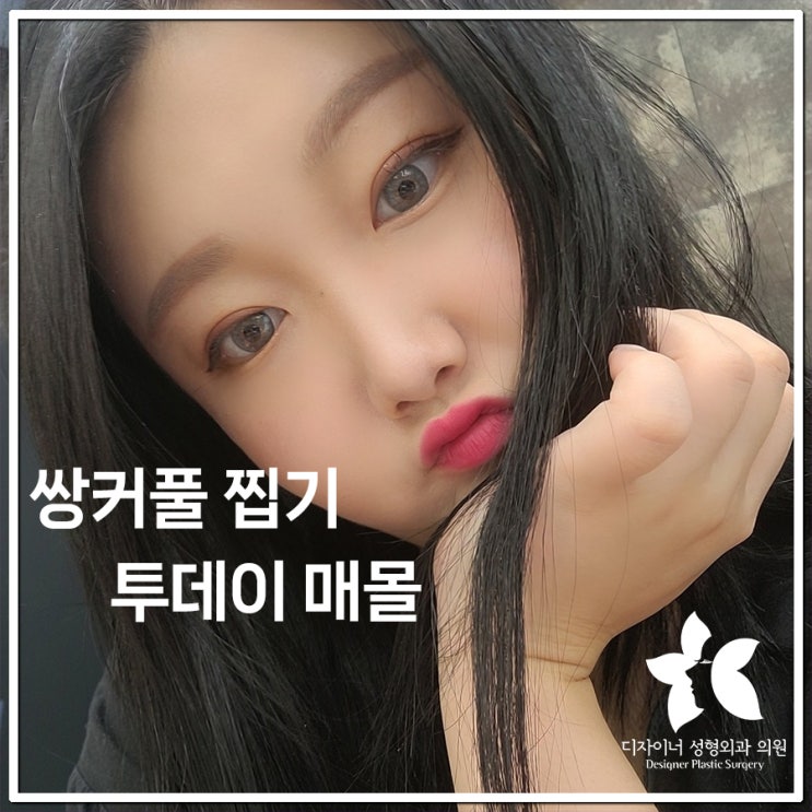  쌍커풀찝기, 자연스럽게 변화하는 눈매의 비밀