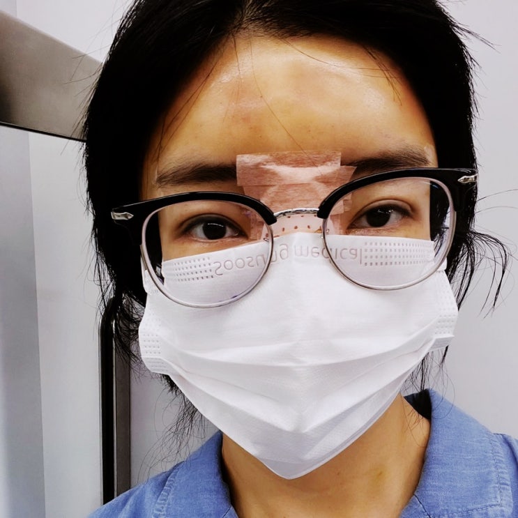 나는솔로 10기 영자 근황, 성형 고백…양악 이어 눈·코·지방이식 “옆모습만 공개한 이유”